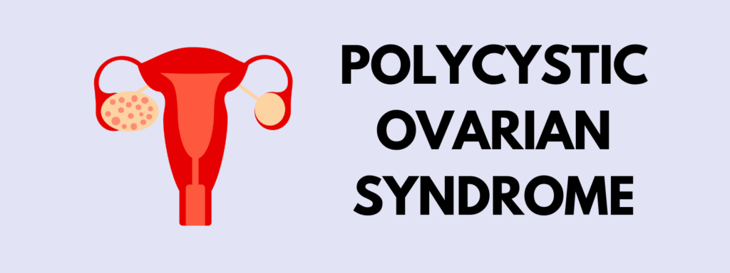 Banner reading "Polycystic Ovarian Syndrome"