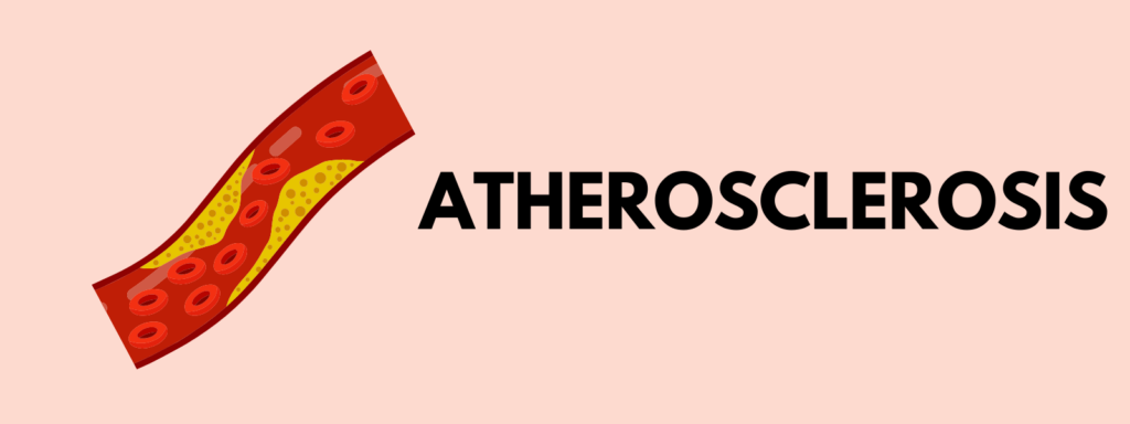 Banner reading "Atherosclerosis"