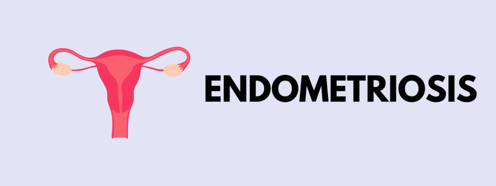 Banner reading "Endometriosis"