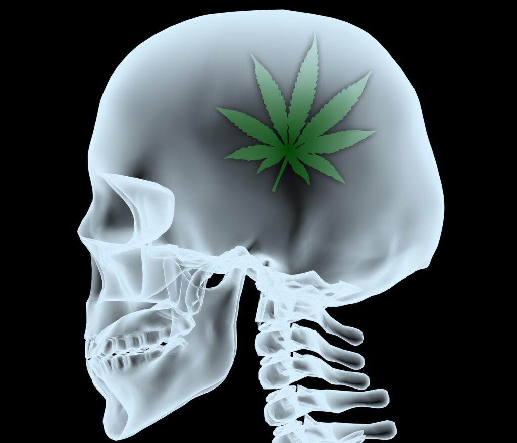 Radiografía de una cabeza con la hoja de marihuana en lugar del cerebro, ilustración 3d