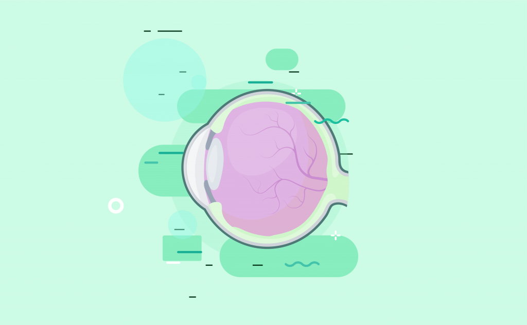 patologia glaucoma